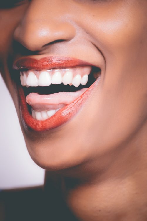 boca mujer dientes